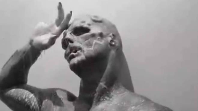 Pour devenir un extraterrestre, cet homme se fait amputer le nez, les oreilles et, maintenant, ses deux doigts